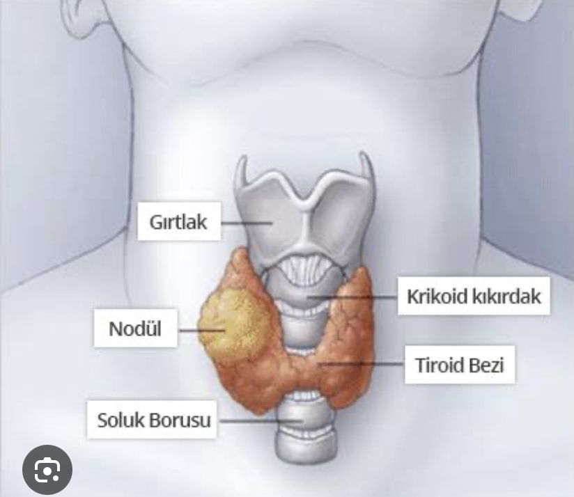 Tiroid Nodülü Ne Zaman Tehlikelidir? Ameliyat Gerektirir mi? | Doç. Dr. Hüseyin Eken